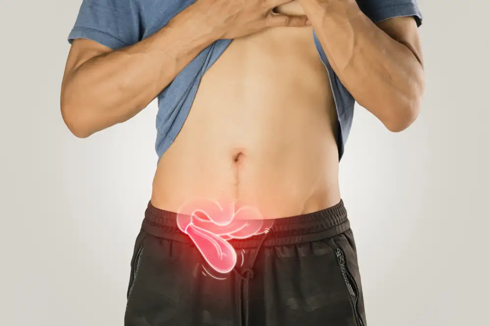 Homem levantando a camisa e mostrando a região inferior do abdômen, com ilustração de dor destacada, representando sintomas de hérnia inguinal. Hérnia abdominal.