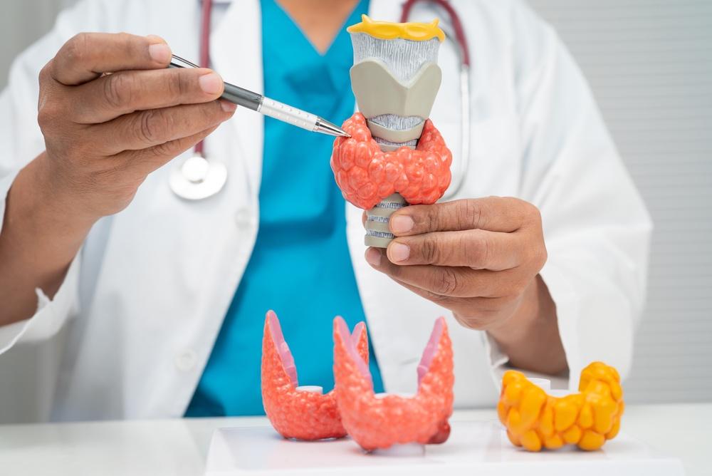 Médico mostrando um modelo de tireoide, explicando como é feita a cirurgia de tireoidectomia.