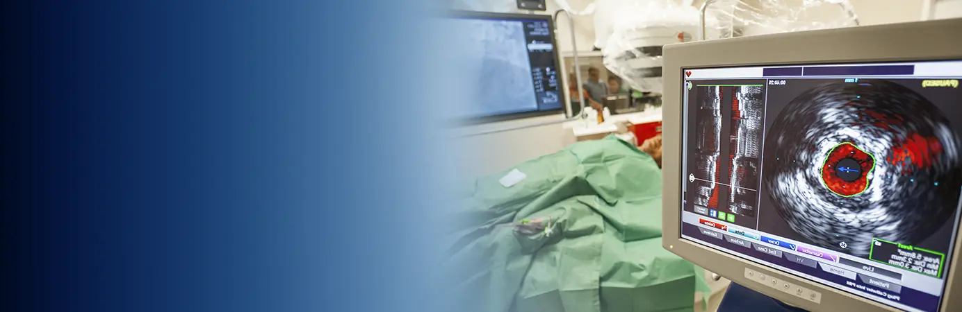 monitor com ultrassom