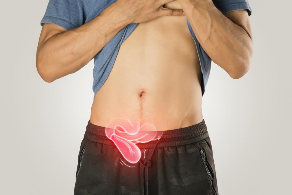 Homem levantando a camisa e mostrando a região inferior do abdômen, com ilustração de dor destacada, representando sintomas de hérnia inguinal. Hérnia abdominal.